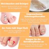 Joycabin Ingrown Toenails Set, Toenail Correction Patch, Ingrown Toenail Correction