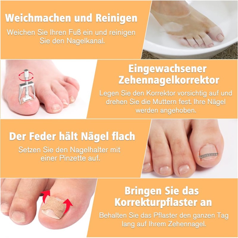 Joycabin Ingrown Toenails Set, Toenail Correction Patch, Ingrown Toenail Correction