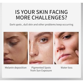Arbutin 7% + Tranexamic Acid 4% Cream, 70,000ppm Arbutin, 40,000ppm TXA, Niacinamide, Glutathione, Dark Spots, Freckle, Blemishes, Pigmentation, Korea