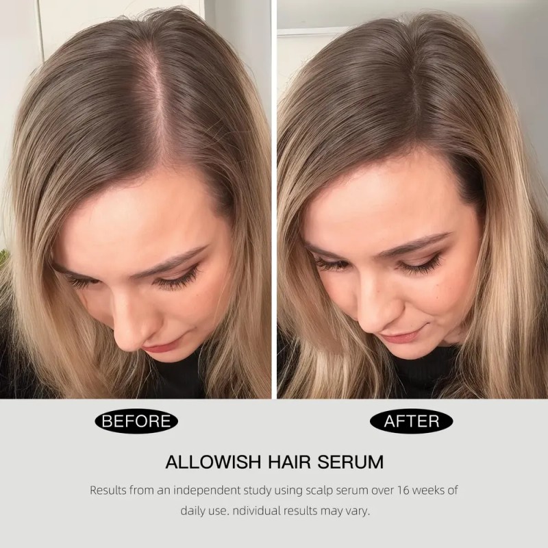 Sérum De Crecimiento Capilar Allowish Rosemary Con Biotina 9