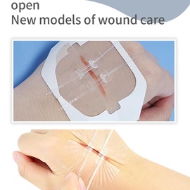 Nähte klebende Bandagen 4 PCS chirurgische Laceration Reparatur ohne Nähen Schnelle Blutgerinnel Notfall Wunde Verschlüsse Gerät Transparent 6cm