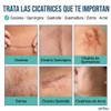 Cinta de Silicona para Cicatrices Grado Médico Rollo 1.5 m,
