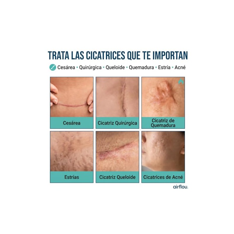 Cinta de Silicona para Cicatrices Grado Médico Rollo 1.5 m,