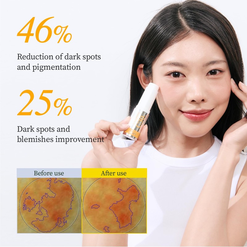 YADAH Vitamin C 30 Correcting Balm (0.35oz) – All-in-one Multi