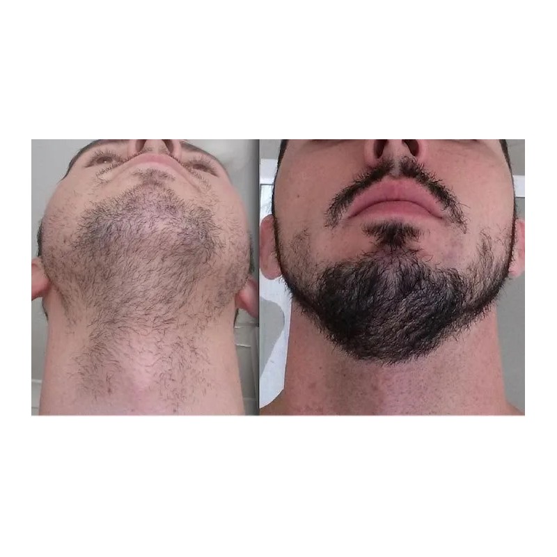 Crecer Barba Bigote Cejas Profesional Y Natural Total