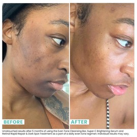 Combination Skin Cleansing Bar - Size: 2.0 oz