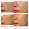 TOSOWOONG Arbutin 7% Glutathione Cream, Dark Spots, Even Complexion, Glow