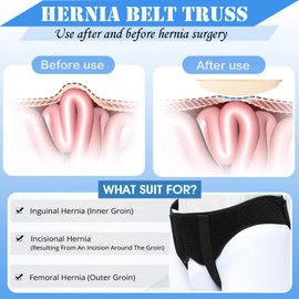 AUSTYLCO Hernia Belt for Men for Women,Adjustable Waist Strap with 2 Removable Compression Pads,Hernia Support Truss for Single/Double Inguinal