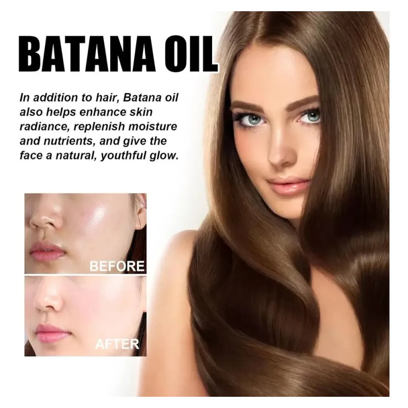 Aceite De Batana Para Crecimiento Del Cabello Hidratada 3pcs