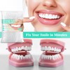 Sukh 10.9oz Thermoplastic Denture Adhesive Beads – Tooth Repair Kit,Repair