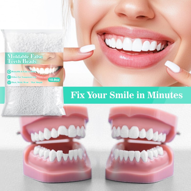 Sukh 10.9oz Thermoplastic Denture Adhesive Beads – Tooth Repair Kit,Repair