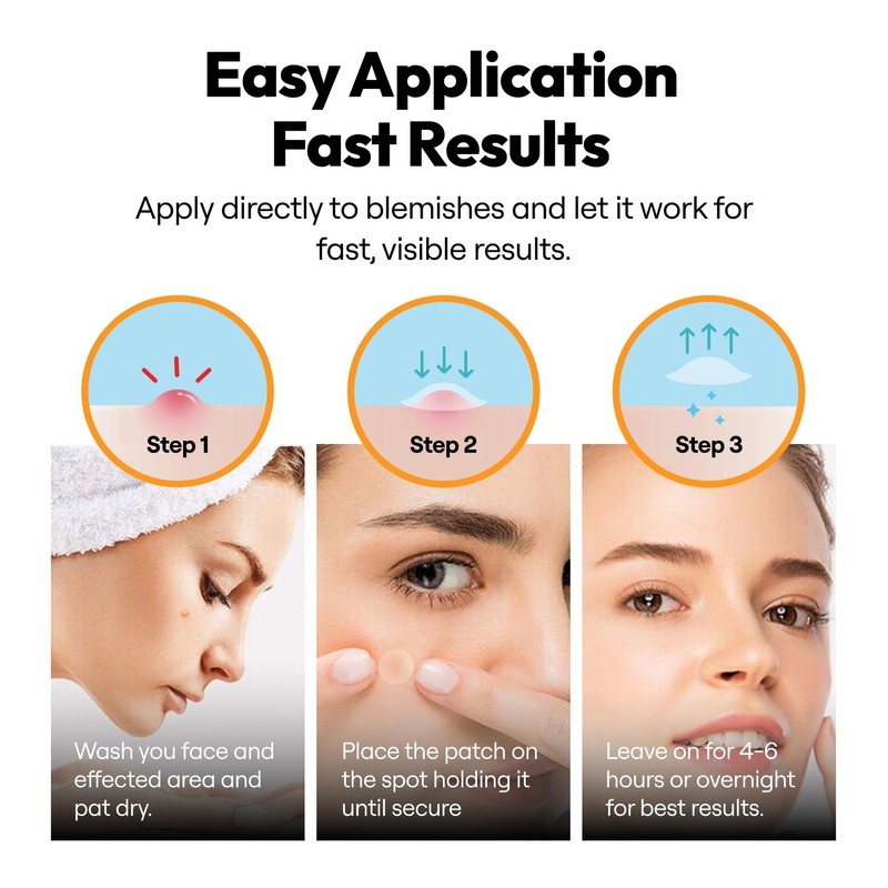 300 Pimple Patches – Hydrocolloid with Salicylic Acid, Tea Tree