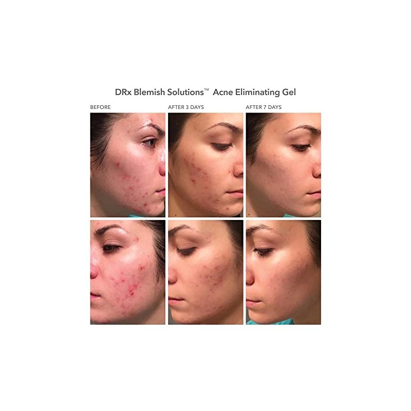 Dr Dennis Gross DRx Blemish Solutions Gel para eliminar el