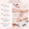 Electric Foot File for Smooth Feet – USB Rechargeable Callus