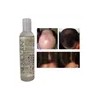 Shampoo Estimulación Del Folículo, Mxshw-001, 1 Pza, 250ml