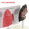 MUCKLILY Lung Comparison Model Medical Teaching Tool vs Normal Lungs