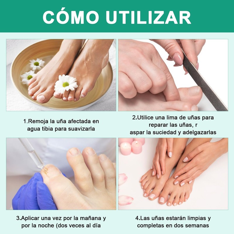2 Piezas Krassentiales Líquido Reparador de Uñas de Los Pies,