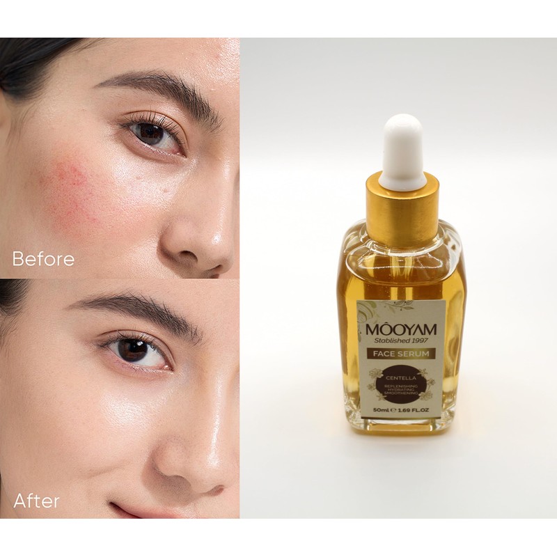 Face Serum for Skin Care | Hydrating | Smoothening -