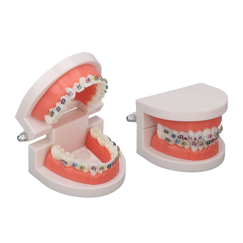 Orthodontic Dental Model, Typodonts Orthodontic Demonstration Model with Metal Wires
