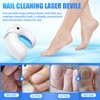 LEEWENYAN Nail Fungus Treatment Device, Highly Efficient Nail Fungus Cold
