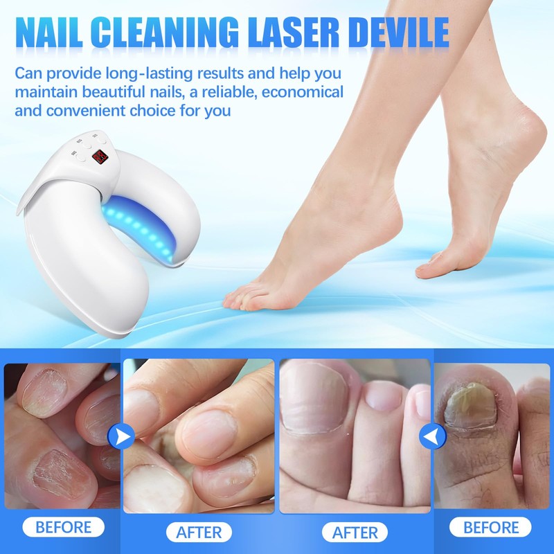 LEEWENYAN Nail Fungus Treatment Device, Highly Efficient Nail Fungus Cold