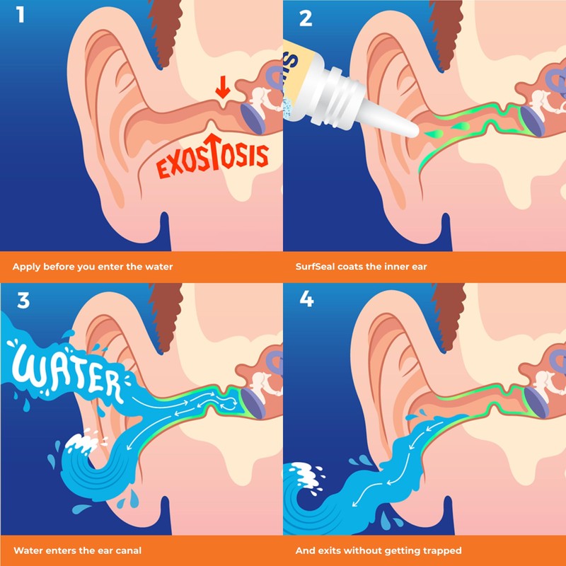 SwimSeal™ All Natural Swimmer's Ear Drops for Daily Use Rather