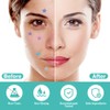 BUTBU Pack of 400 Star-Shaped Pimple Patch, Hydrocolloid Pimple Patch