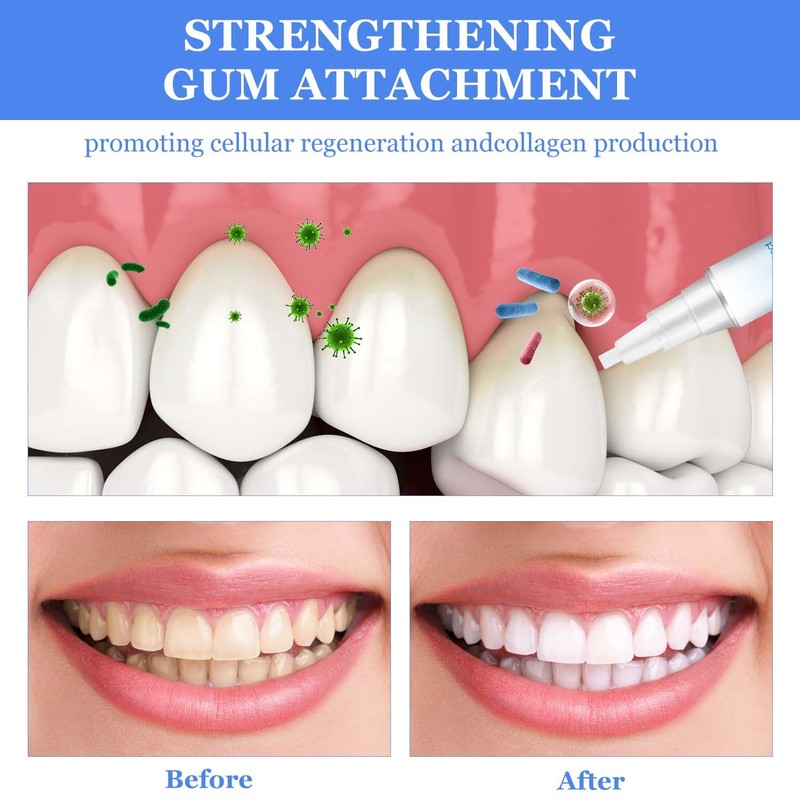 BSOON Gum Therapy Gel, Pack of 3 Teeth Whitening Pen