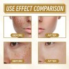 Crema Quitamanchas Hidratante 20g Para Rostro Todo Tipo De Piel
