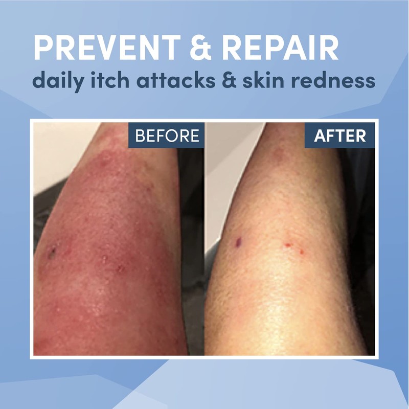 Bamboo Eczema Gloves (9-10 years)