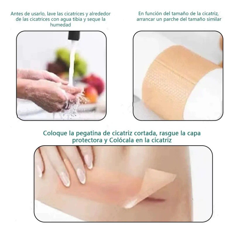 2 cajas Parche de silicona para cicatrices, adecuado para cicatrices