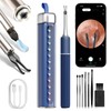 MEKK Ear Wax Removal Kit S5 with 10 MP Camera,