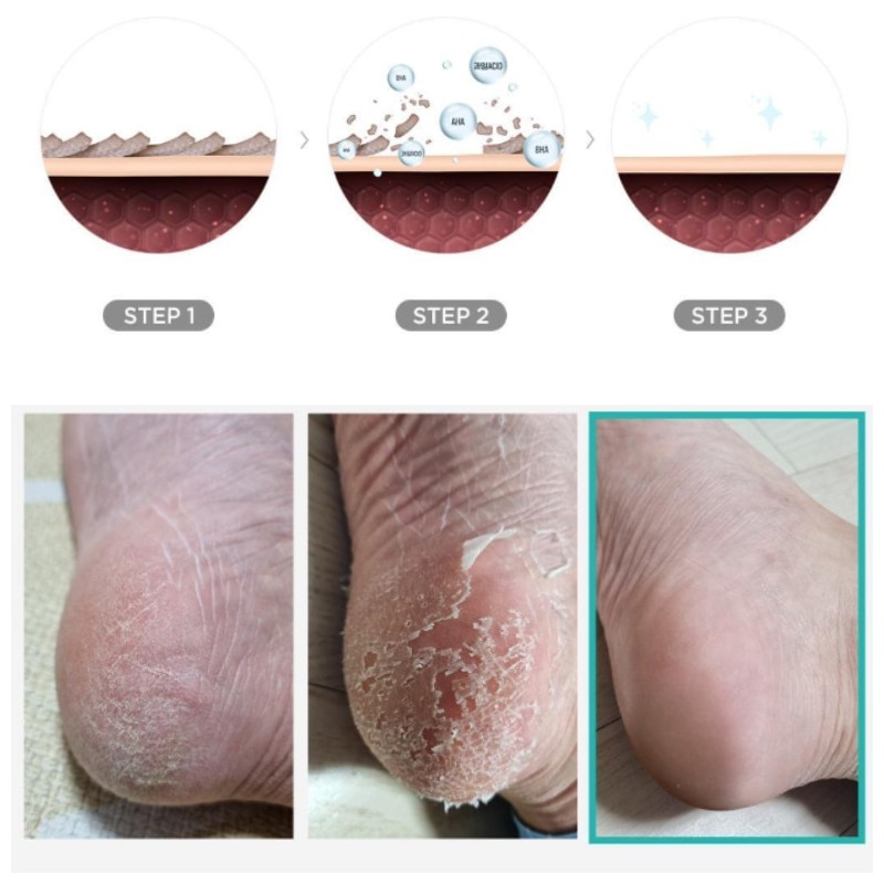 ARIUL Smooth & Pure Foot Peeling Mask 34g*2ea, Type:Rice Nourishing