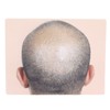 Man Bald Micropigmentattion Practice Skin Silicone Hairline Microblading Practice Pads