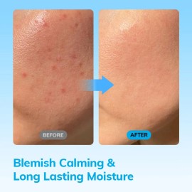 Crema Calmante Refrescante I.n.g | Hidratante Profunda Y Cal