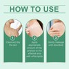 Vitiligo Cream, Natural Effective Vitiligo Treatment for Reduce White Spots
