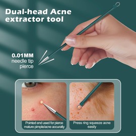 Upgrade Facial Blackhead Remover Tweezers, Ingrown Hair Tweezers,Extractor Acne Removal, Pimple Popper Tool suit (Green, One size)