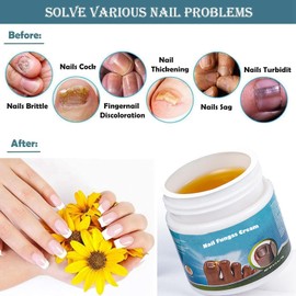 Nail Care Cream, 20g Nails Toenails Essence for Discolored Damaged Nails - Nail Herbal Essence for Nourish Change Thick Cracked Discolored Nails