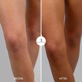 Gatineau - Tan Accelerating Lotion (200ml) + Golden Glow Gradual Tan (200ml) Duo Set, Total Body Glow, Natural Tanning For Face and Body