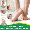 Aloe Vera Foot Care Stick with 60% Urea - Relief