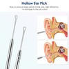 Ear Cleaning Kit,Safe Ear Wax Removal Tool,Earwax Removal Kit,Easy to