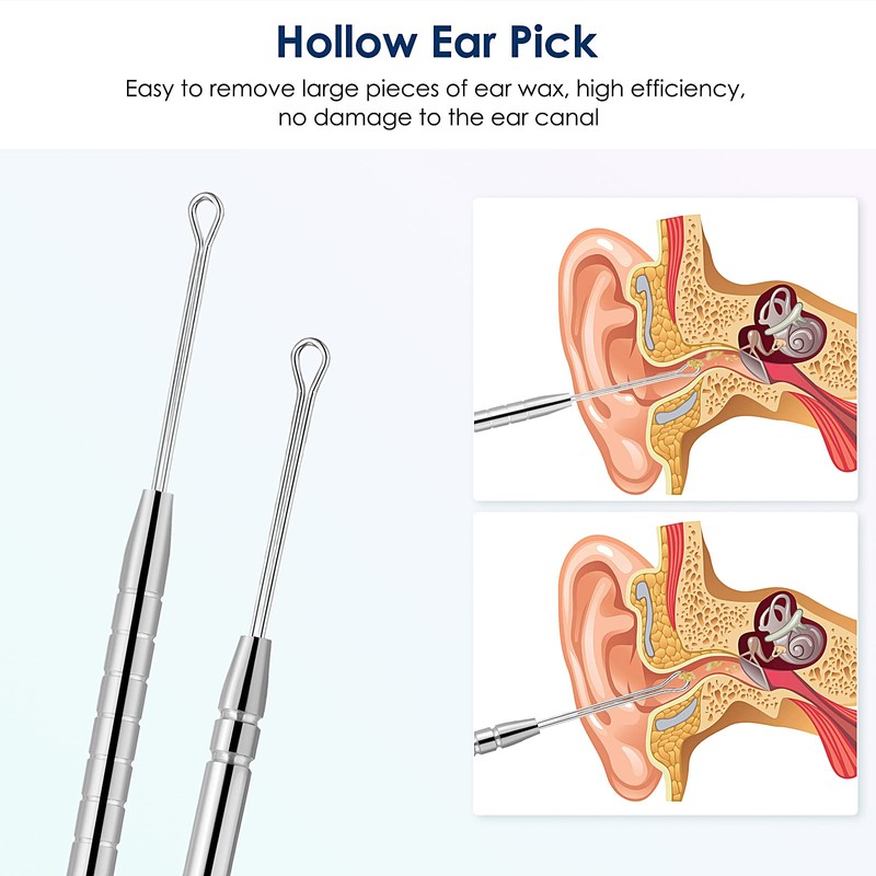 Ear Cleaning Kit,Safe Ear Wax Removal Tool,Earwax Removal Kit,Easy to