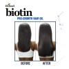 Biotina Aceite Tratamiento Capilar Crecimiento Cabello Sano