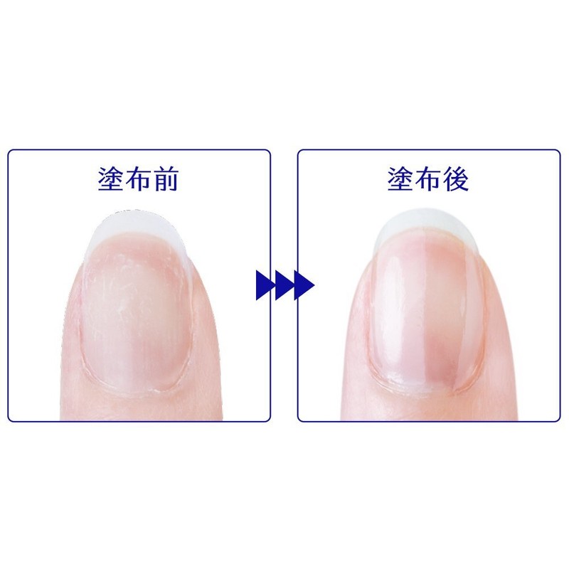 D-Up Repair Nail Serum, 0.3 fl oz (10 ml)