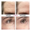 Vitayes Instant Ageback Crema Levantamiento Facial Todo Tipo Piel Día