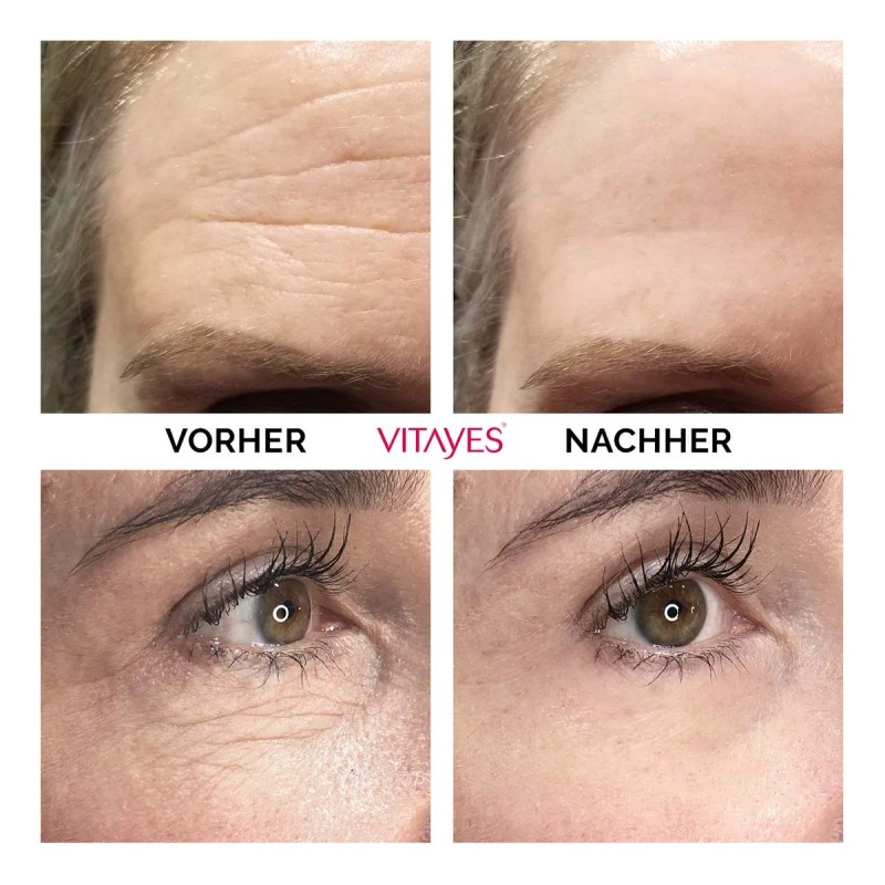 Vitayes Instant Ageback Crema Levantamiento Facial Todo Tipo Piel Día