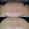 BIODERMA, Crema Facial Hidratante, Sensibio Defensive, Fortalece la Barrera Cutánea,