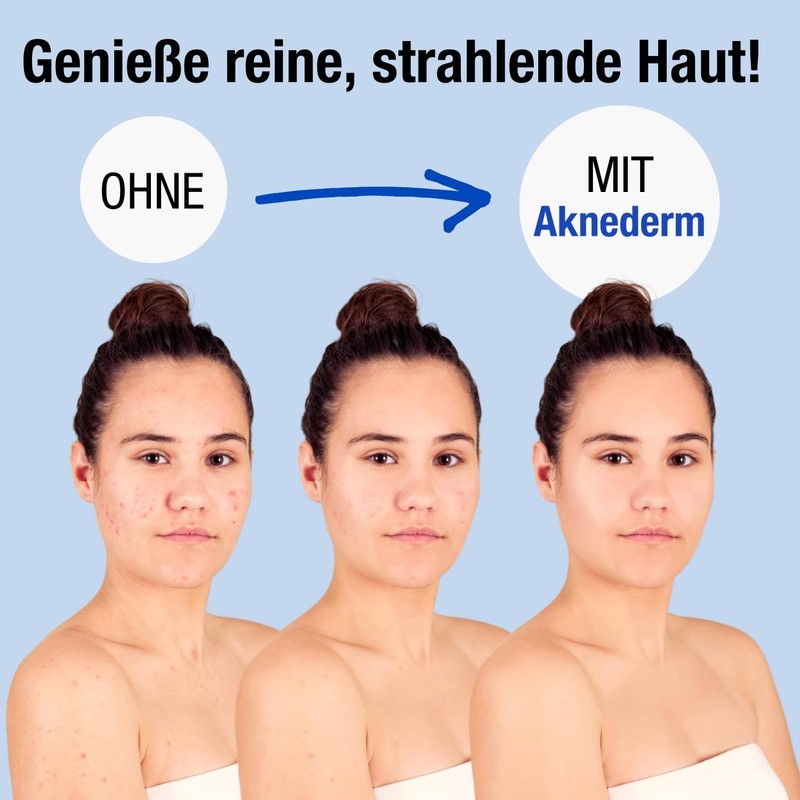 Aknederm Creme Intens