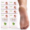 SpaLife Moisturizing Foot Mask | Foot Wrap for Dry Cracked