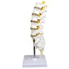 Science Resource S08530 Medical Grade, Articulated Lumbar Spinal Column |